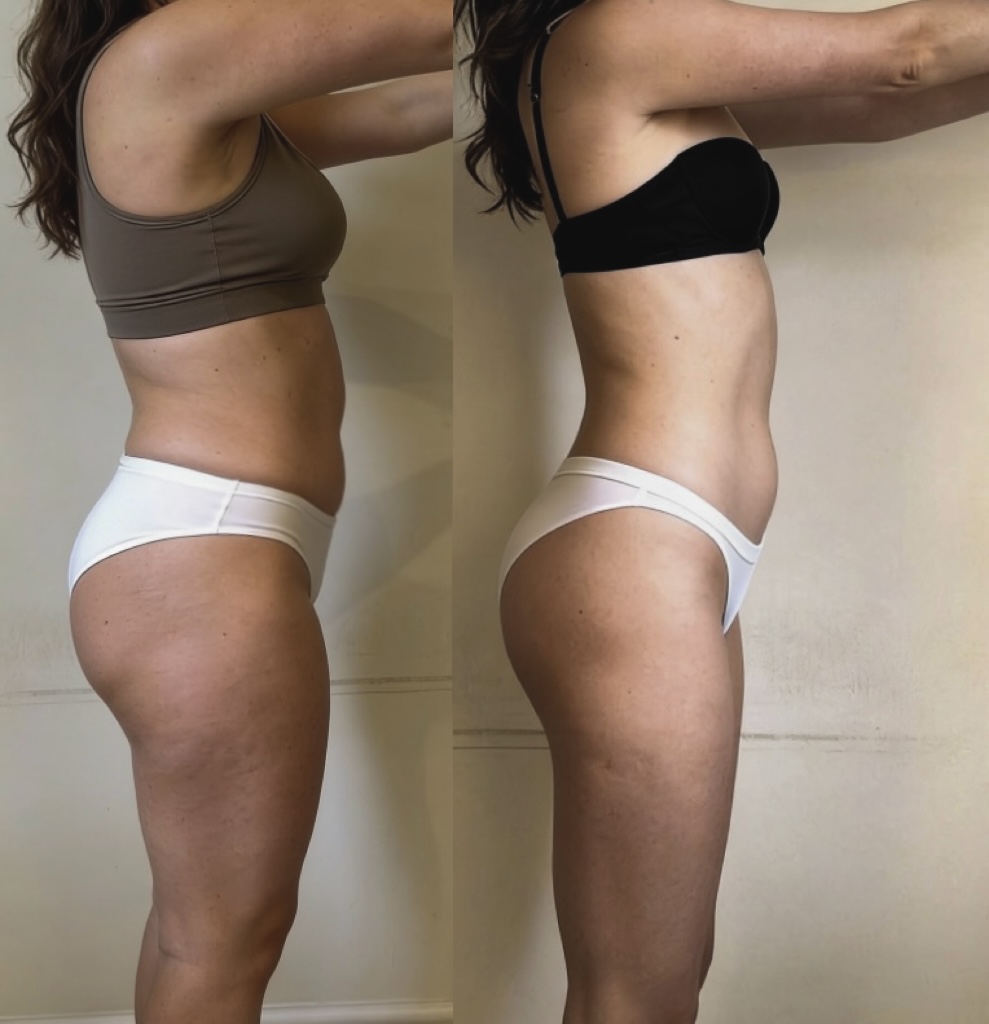 Testimonianza percorso InArmonia